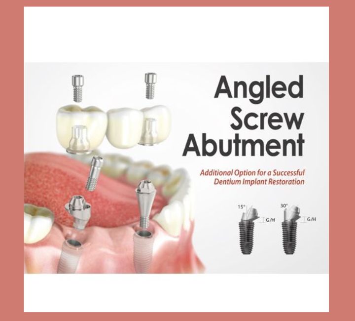 Angled Screw Abutments flyer