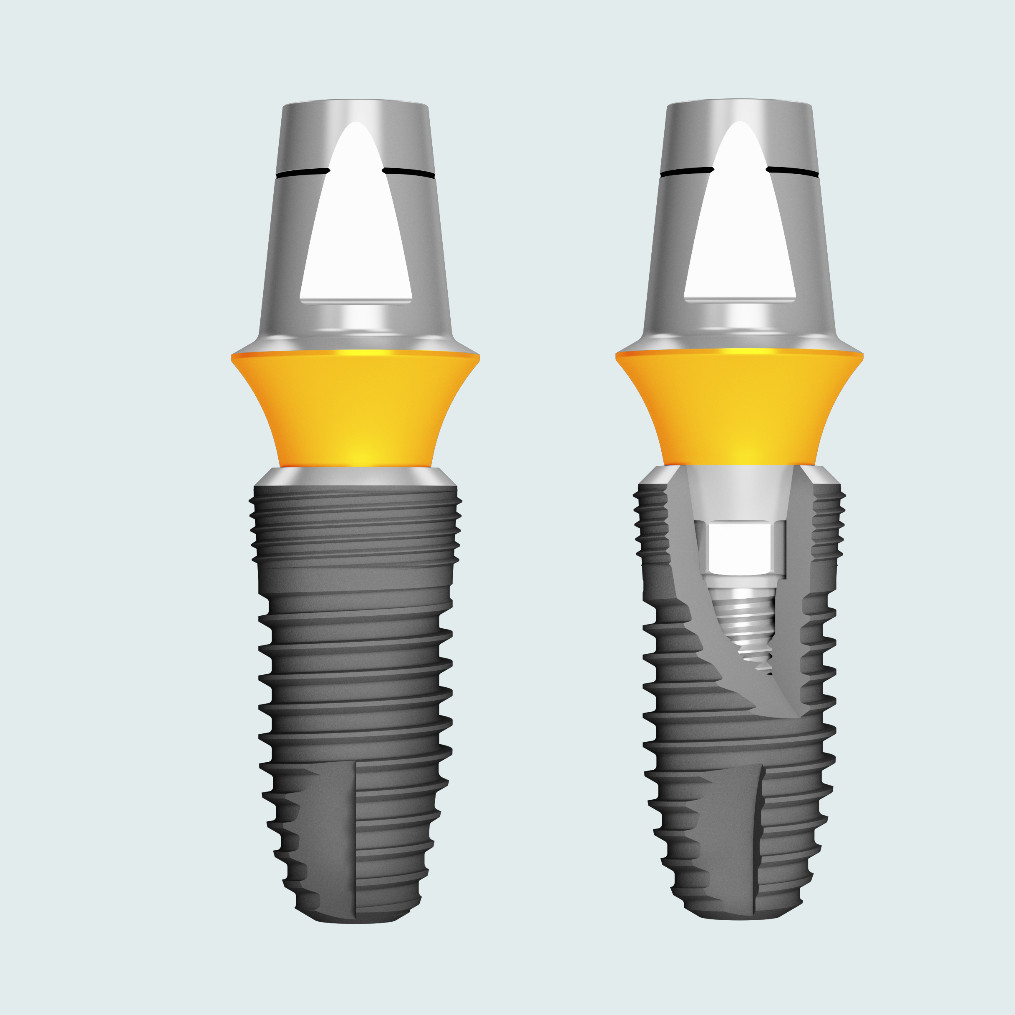 Superline Implants