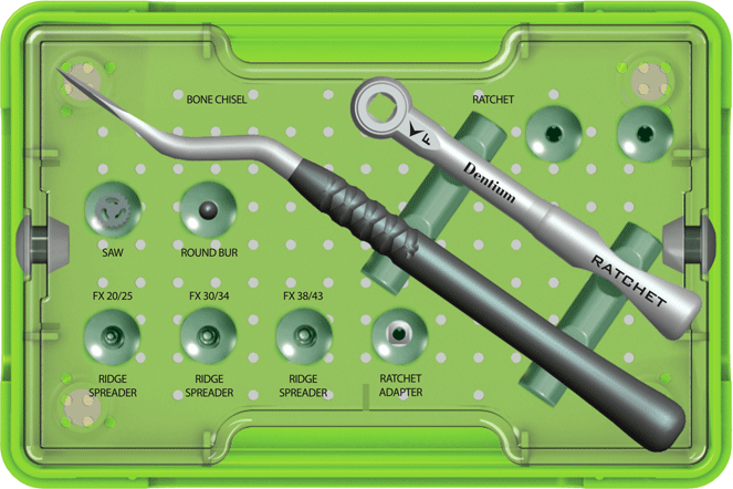 Ridge Spreader(RS) Kit