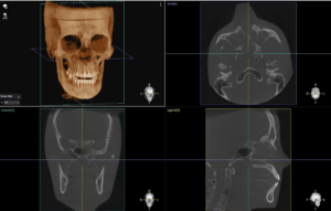 Dentium E-rainbow CT_R01-L 3IN1(CT+PANO+LINE CEPH) - Image 3
