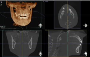 Dentium E-rainbow CT_R01-L 3IN1(CT+PANO+LINE CEPH) - Image 4