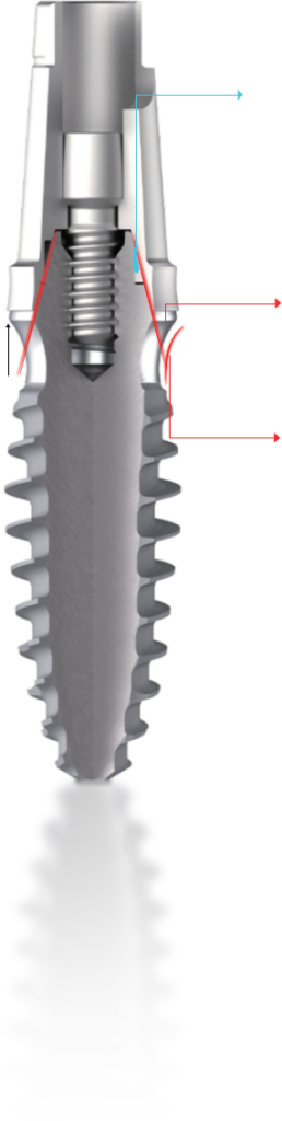 Dentium Bright implant