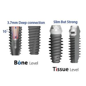 bright implants-